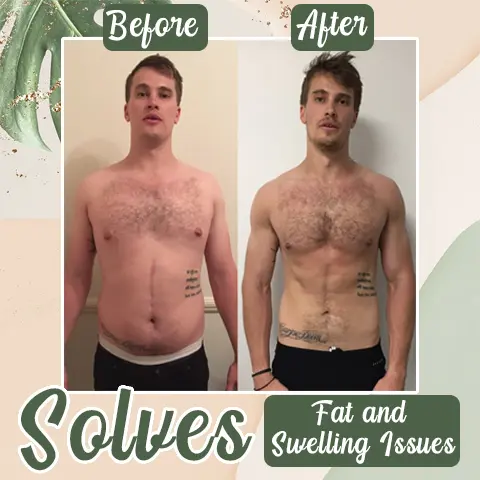Perfect Detox Slimming Patch - Image 6