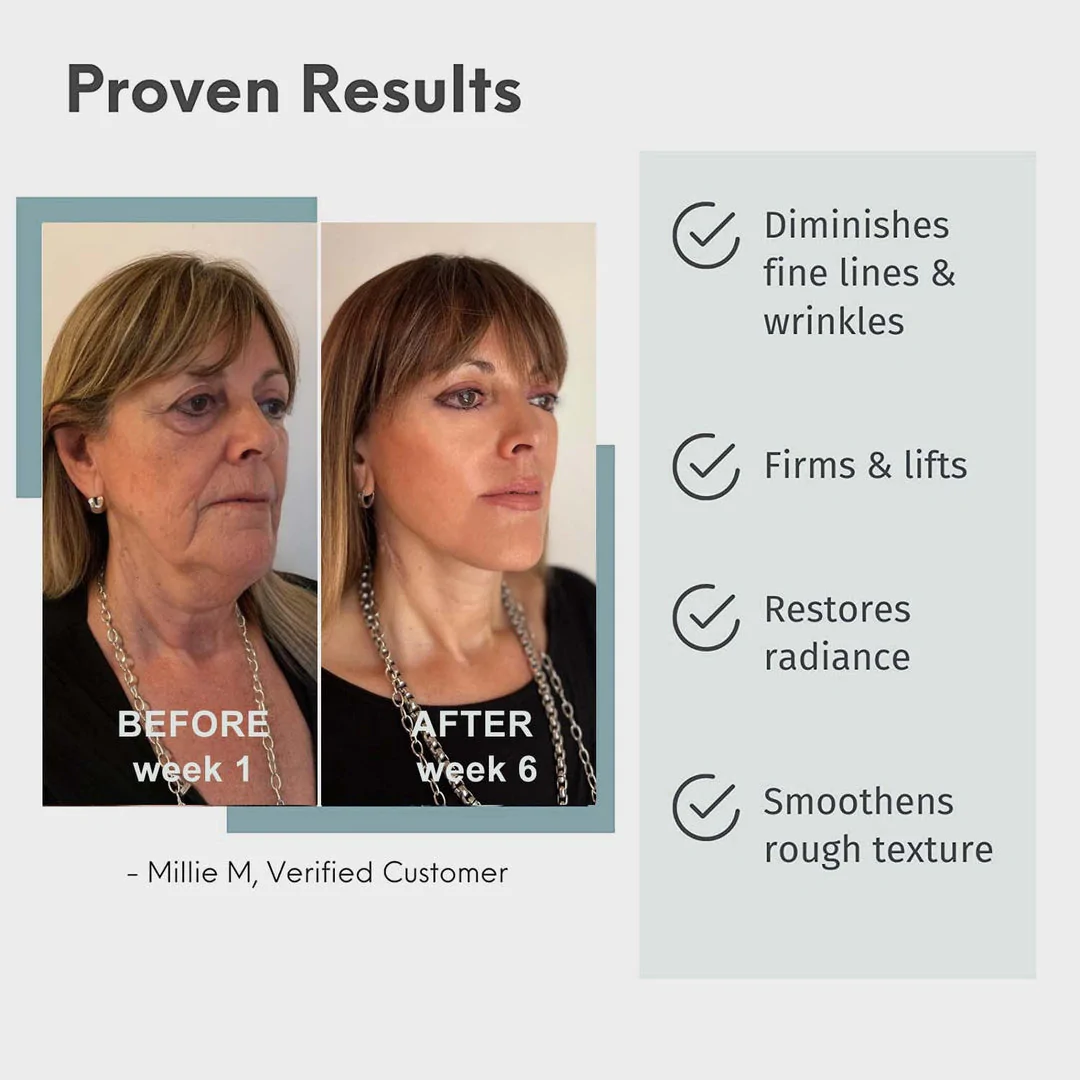 Advanced Collagen Boost Anti Aging Serum - Image 2