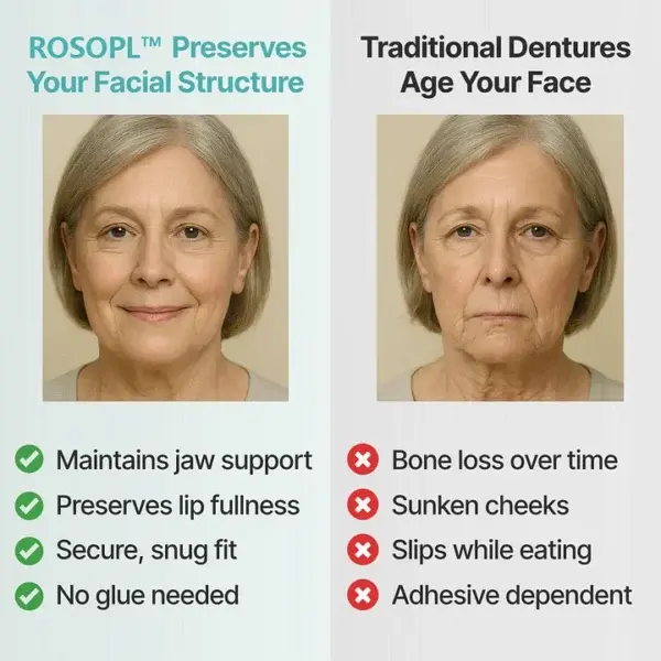 Premium Custom Dentures - Image 6