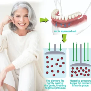 – Immediate Dentures: The Ultimate Fit You Can’t Resist!
