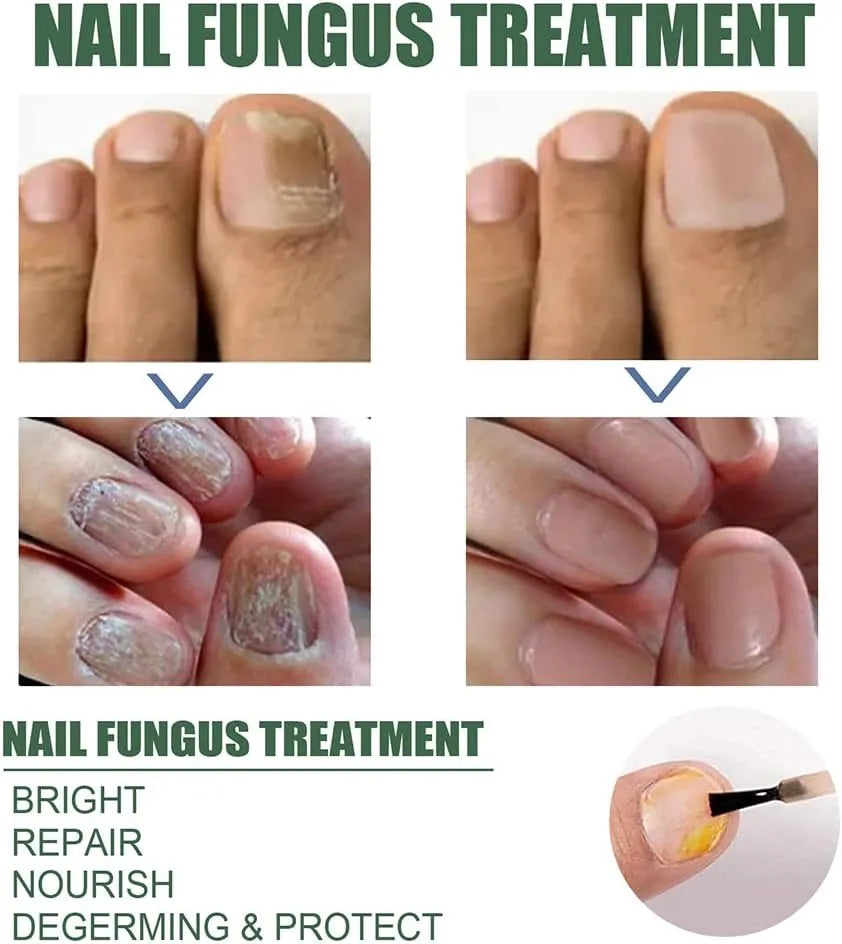 Nail Repair Serum - Image 6