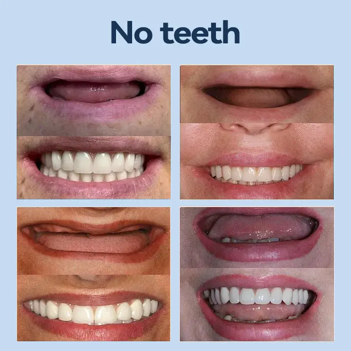 𝐌𝐞𝐝𝐢𝐜𝐚𝐥𝐅𝐢𝐭 𝐀𝐝𝐚𝐩𝐭𝐢𝐯𝐞 𝐃𝐞𝐧𝐭𝐮𝐫𝐞𝐬 - Image 8