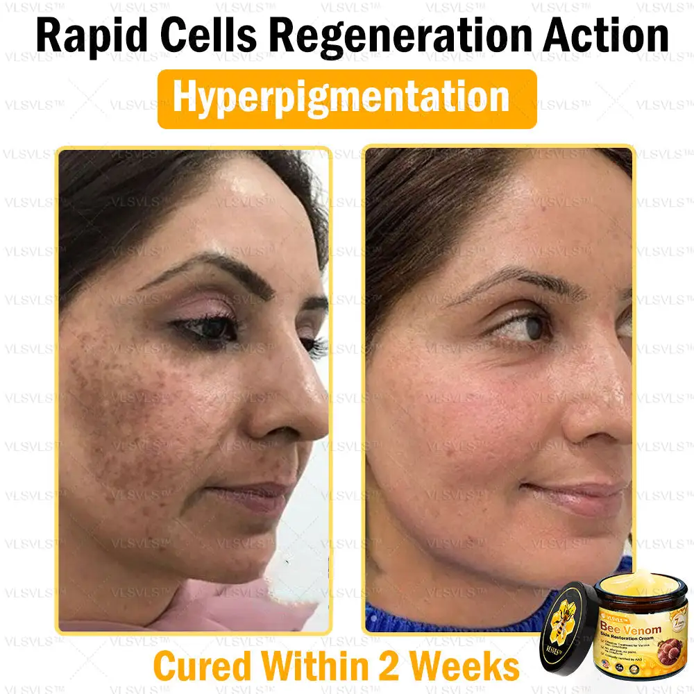 Special Sale Bee Venom Skin Restoration Cream - Image 8
