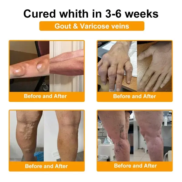 Botulinum Toxin & Bee Venom Pain-Relief Bone Healing Cream - Image 16