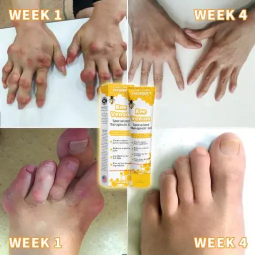 Bee Venom Joint Therapy Pain Relief Gel - Image 3