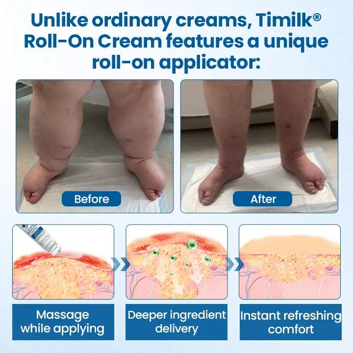 Lymphora Swelling Relief Roll-On - Image 4
