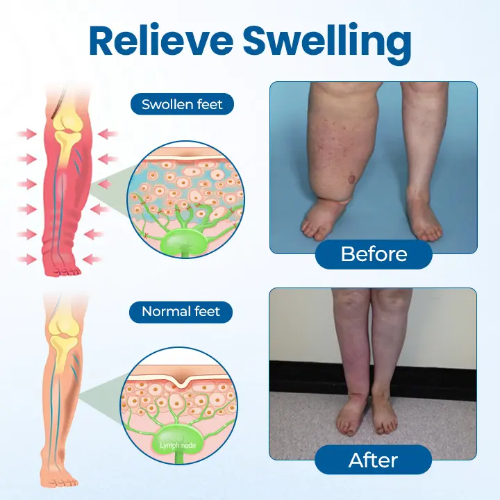 Lymphora Swelling Relief Roll-On - Image 5