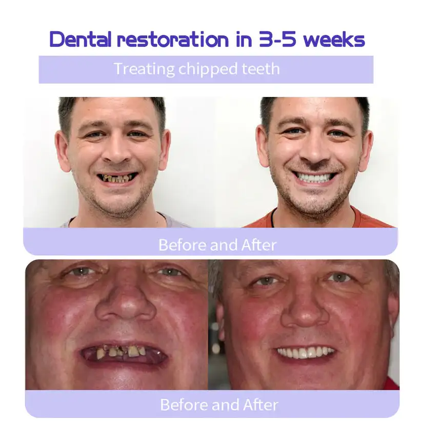 Winter Sale Teeth Restoration Mineral Powder - Image 5