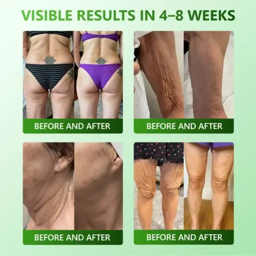 𝐅𝐢𝐫𝐦𝐢𝐧𝐠 & 𝐀𝐧𝐭𝐢-𝐖𝐫𝐢𝐧𝐤𝐥𝐞 𝐒𝐭𝐞𝐦 𝐂𝐞𝐥𝐥 𝐂𝐨𝐥𝐥𝐚𝐠𝐞𝐧 𝐃𝐫𝐨𝐩𝐬 - Image 3
