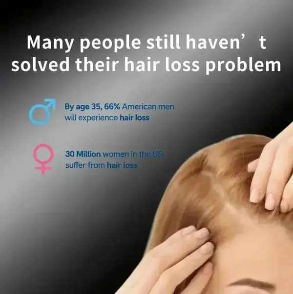 Professional Anti-Hair Loss Roll-On - Image 4