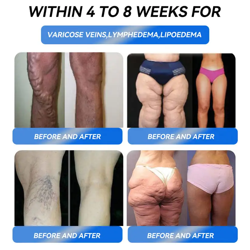 Slimming Support Drops - Image 10