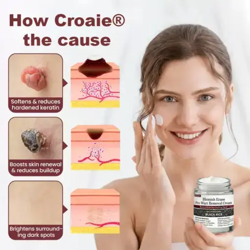 Blemish Erase Pro Wart Removal Cream - Image 7