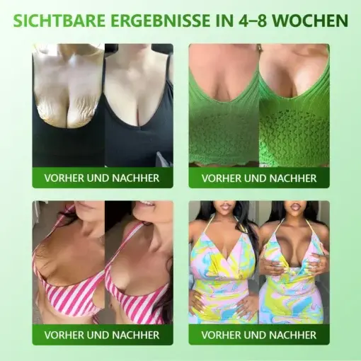 𝗬𝗼𝘂𝐭𝐡𝐆𝗹𝗼𝘄 𝑺𝒕𝙖𝙢𝙢𝙯𝙚𝒍𝒍𝒆𝒏 𝙆𝙤𝒍𝒍𝒂𝙜𝙚𝒏 𝗧𝗿𝗼𝒑𝐟𝙚𝙣 - Image 4