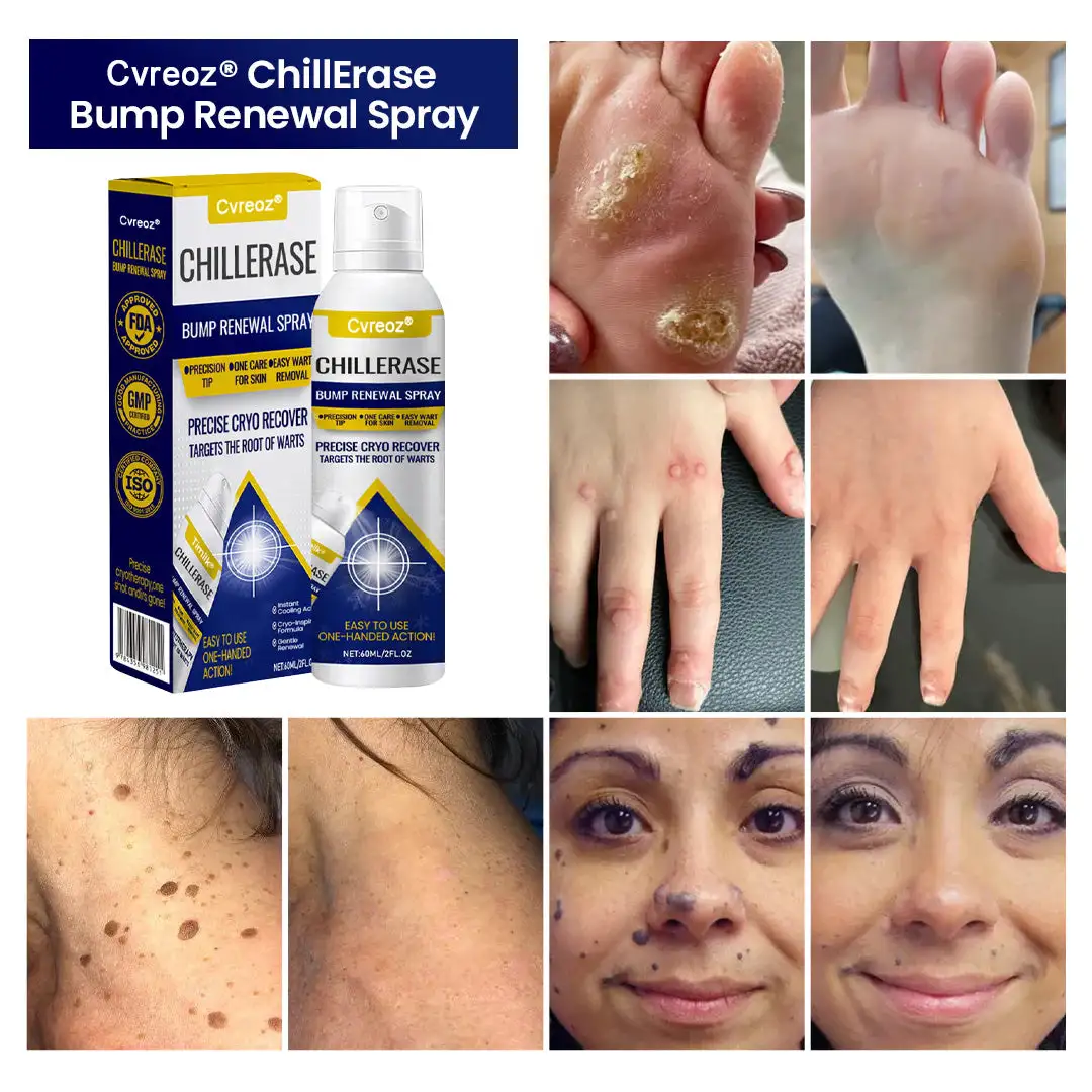ChillErase Bump Renewal Spray - Image 2
