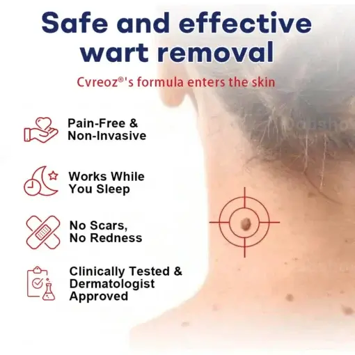 Mole and Wart Removal Cream - Image 4