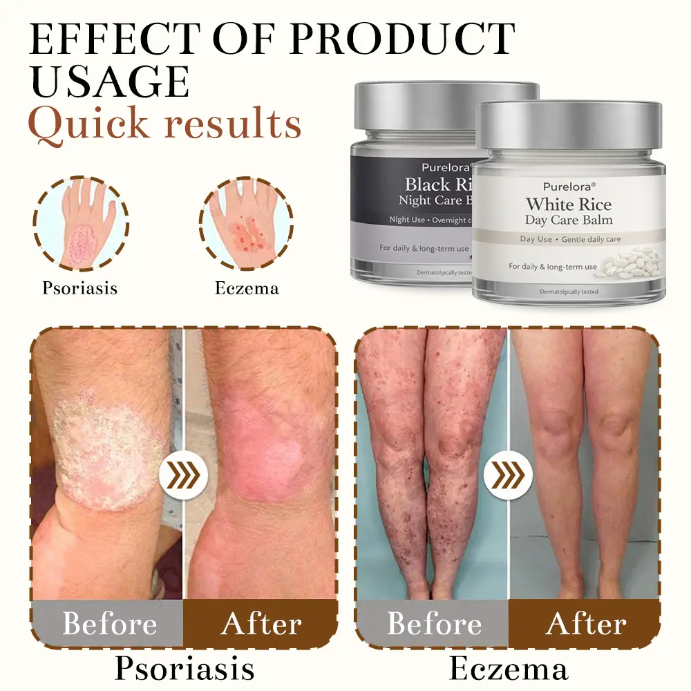 Black and White Rice Day and Night Dual Repair Cream - Image 3