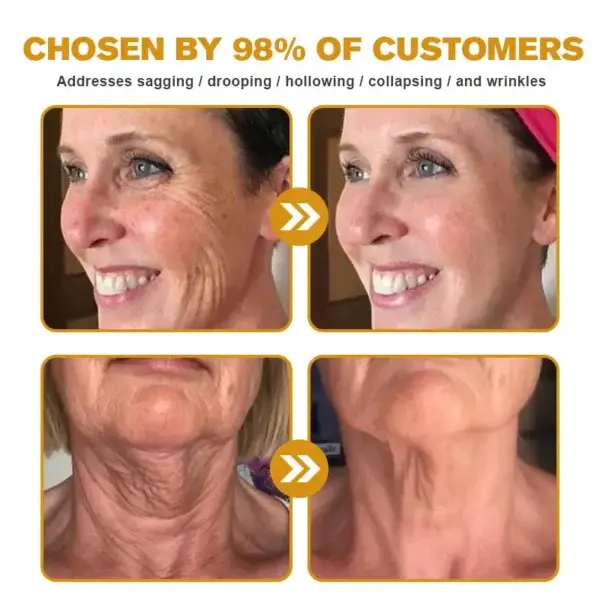 Botox Bee Venom Wrinkle Removal Cream - Image 6