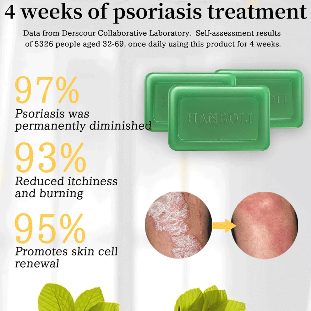 Herbal Psoriasis Treatment Soap - Image 2