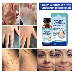 Alternative view of WartLift Wart Removal Fluid