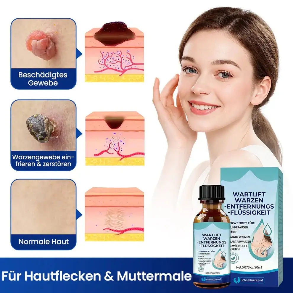 WartLift Wart Removal Fluid - Image 3