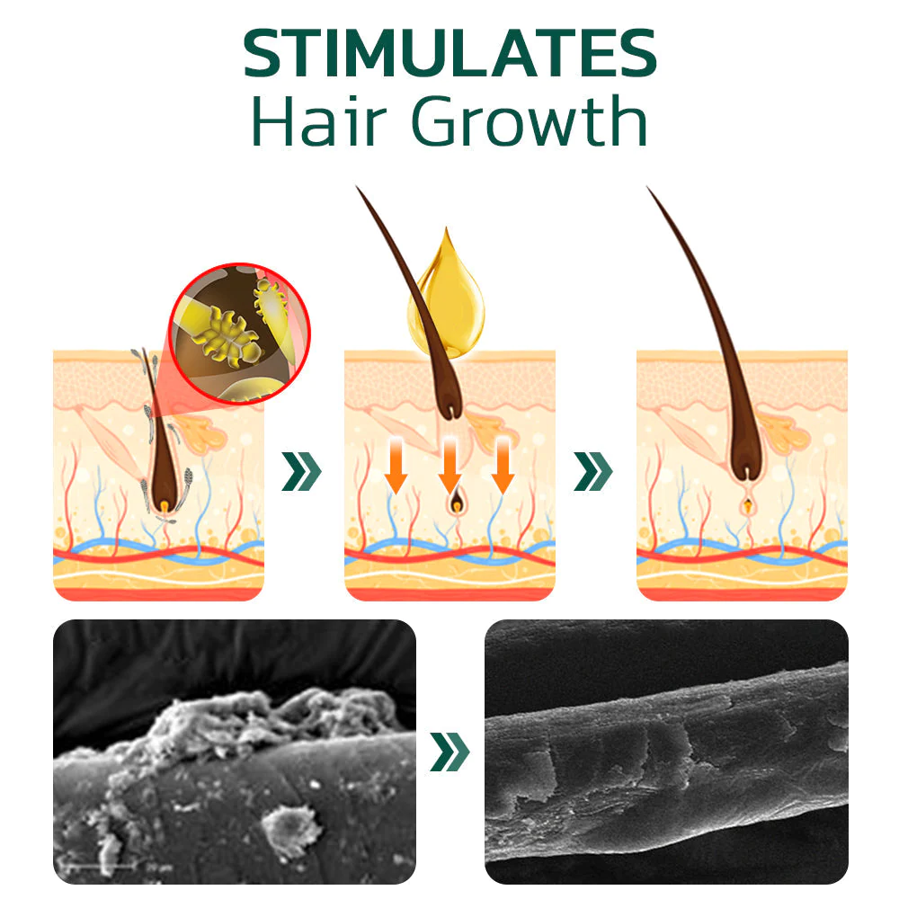 Scalp Folliculitis Therapy Oil - Image 4