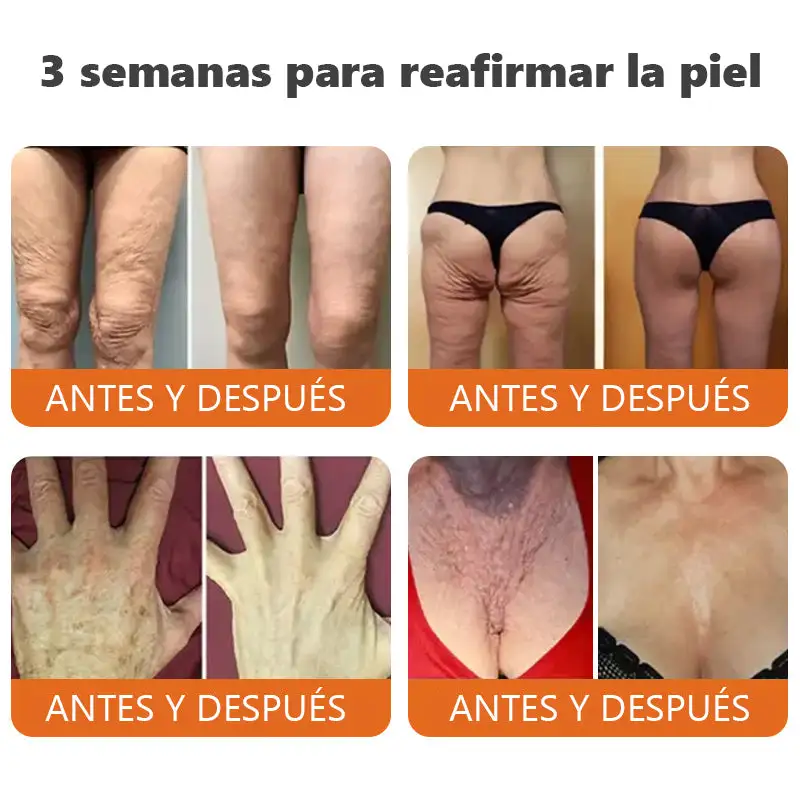 barra de esencia reafirmante con botox y veneno de abeja - Image 3