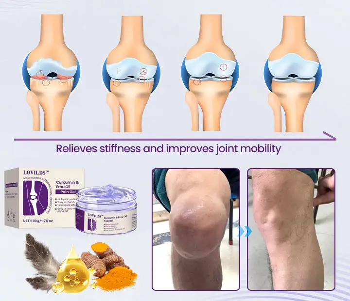 (🔥LAST DAY SALE - 80% OFF) Curcumin & Emu Oil Pain Gel – 🏥Backed by US Osteopathic Experts - Image 10