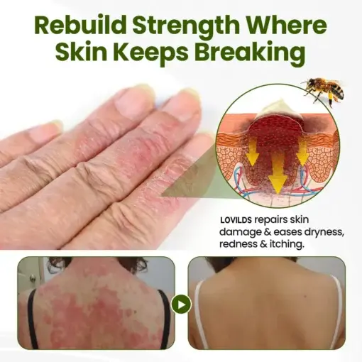 BeePeptide RootSoft DualRelief Cream - Image 4