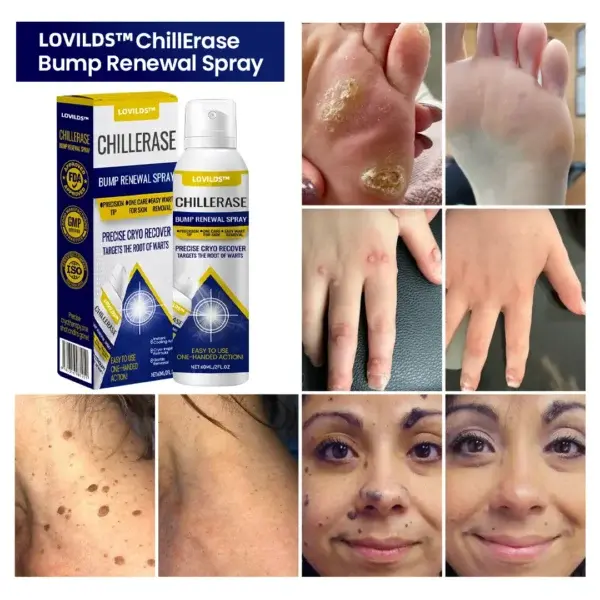 ChillErase Bump Renewal Spray - Image 3
