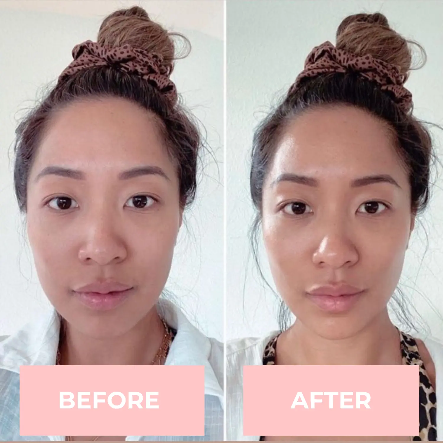Instant FaceLift LED Facial Sculptor - Image 5