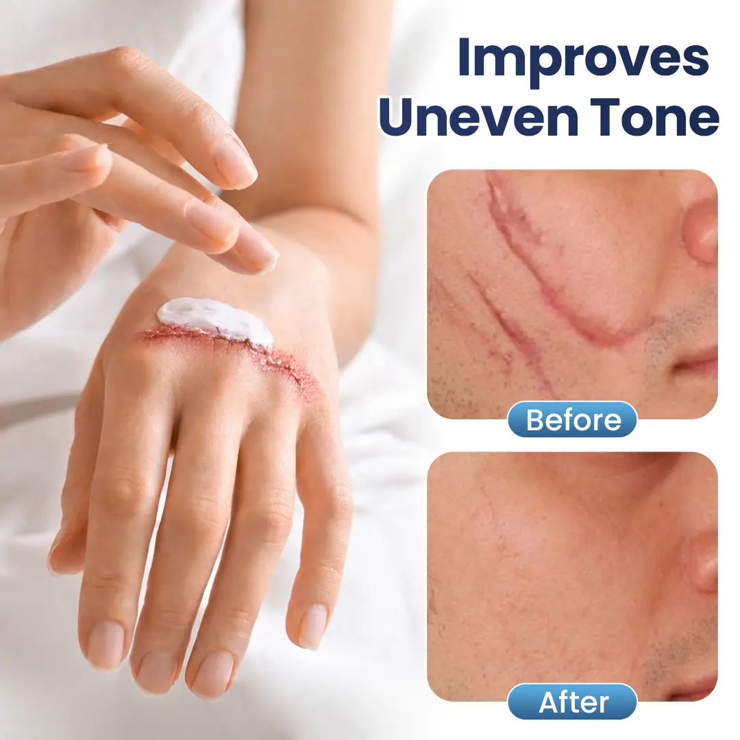 DERMALUX Texture Repair Gel - Image 3