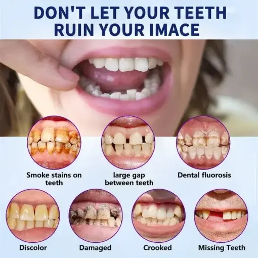 - Advanced Customized Full Denture Set - Image 10