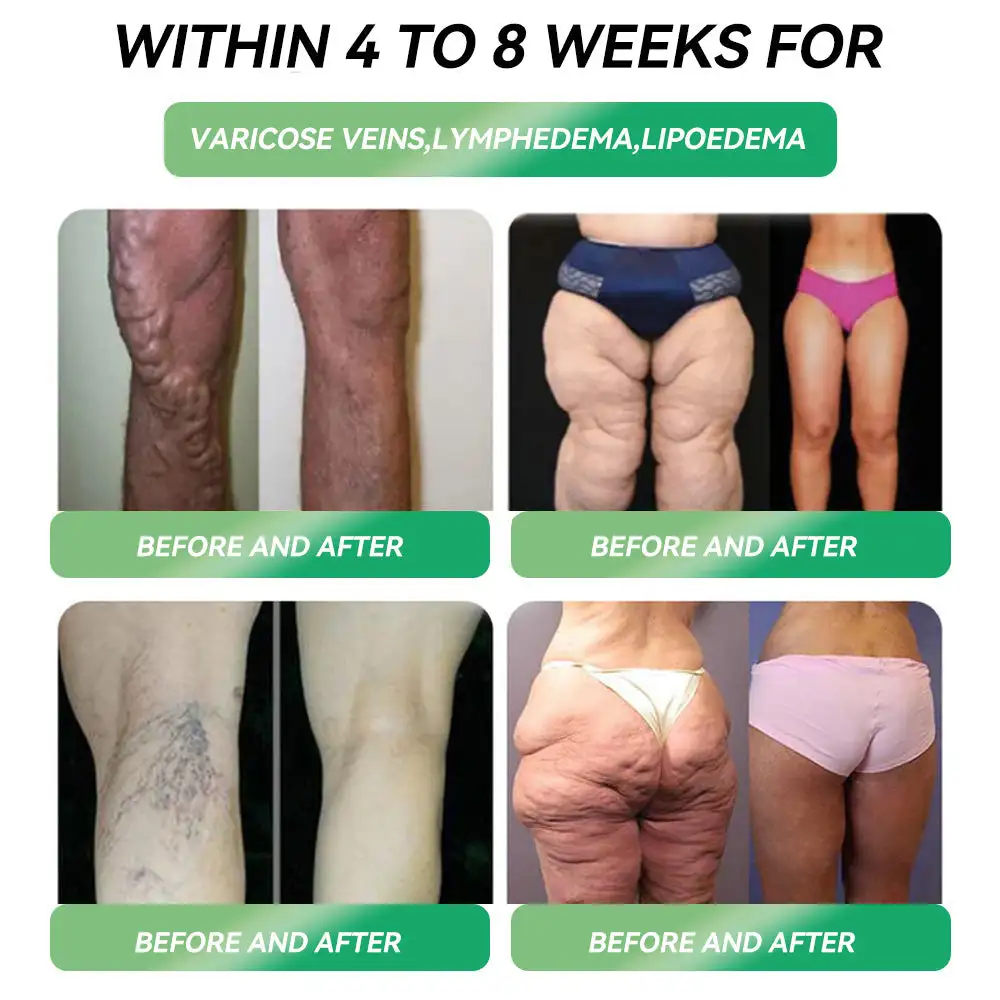 weight loss oral solution - Image 4