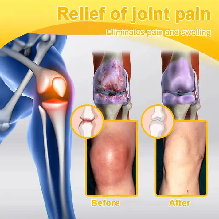 Bee Venom Pain Relief Joint Repair Cream - Image 18