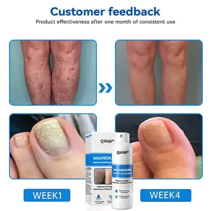 QIAWI Magnesium Herbal Psoriasis Spray - Image 10