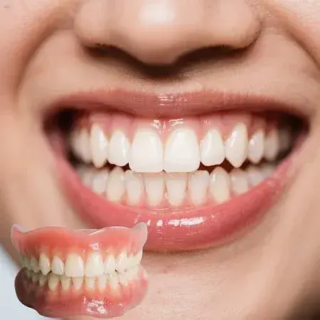 Dentures–Smile Confidently Again in Just 3 Minutes – No Dentist Needed! - Image 3