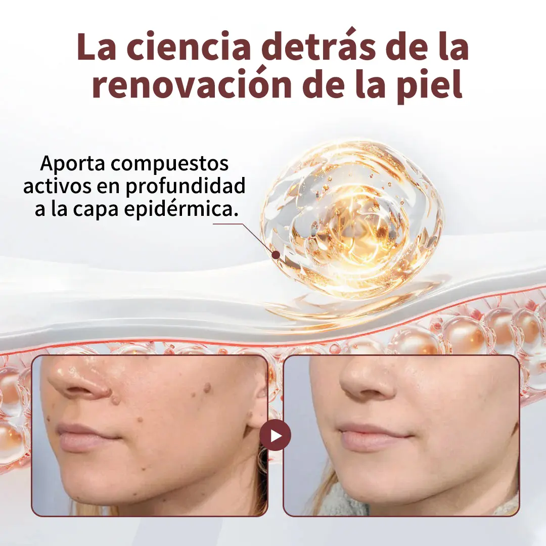 KeraErase Crema Renovadora de Doble Acción - Image 4