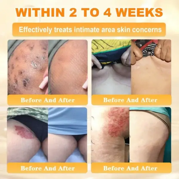 Bee Venom Skin Restoration Cream - Image 10