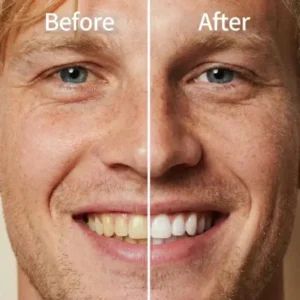 Alternative view of — Instantly Whiter Smile