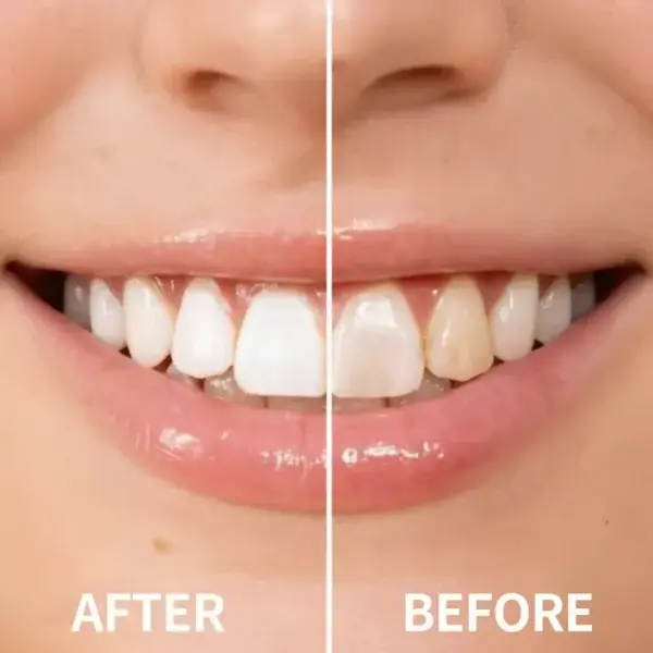 — Instantly Whiter Smile - Image 5