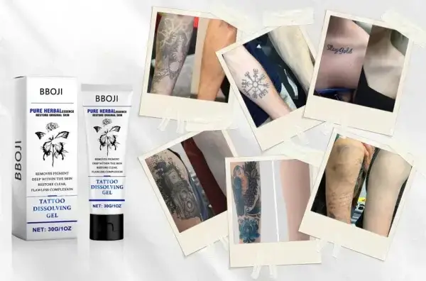 Tattoo Removal Cream - Fast Painless & Scar-Free Tattoo Erasure - Image 10