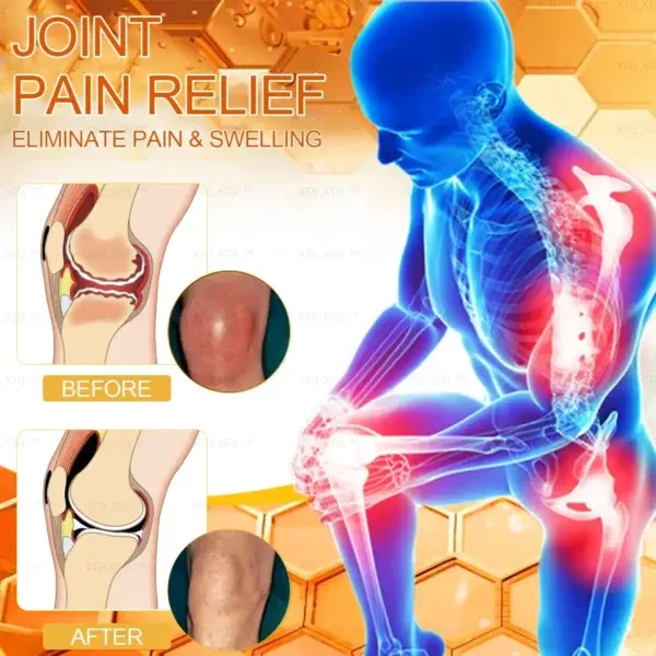 Bee Venom Arthritis Therapy Cream - Image 9