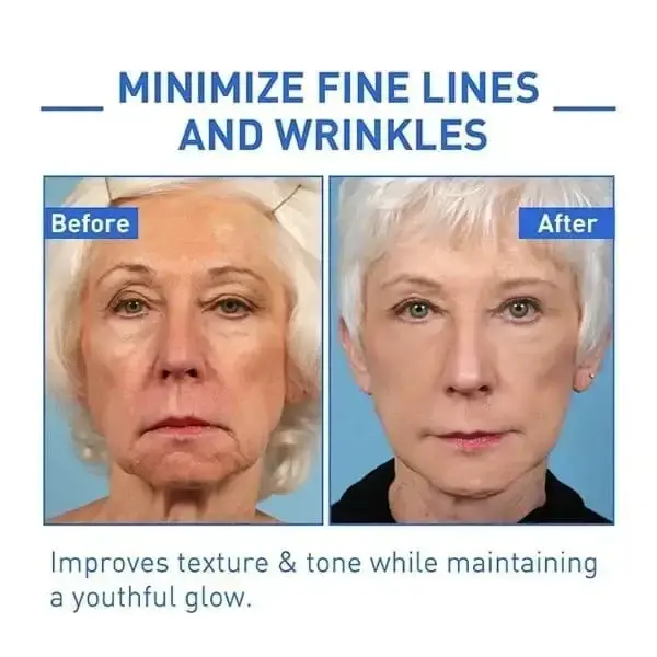 BotoxMAX Face Serum - Image 2