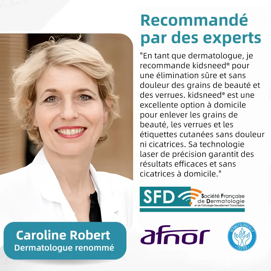 Grains de beauté et verrues non invasifs Stylo laser d'élimination - Image 4