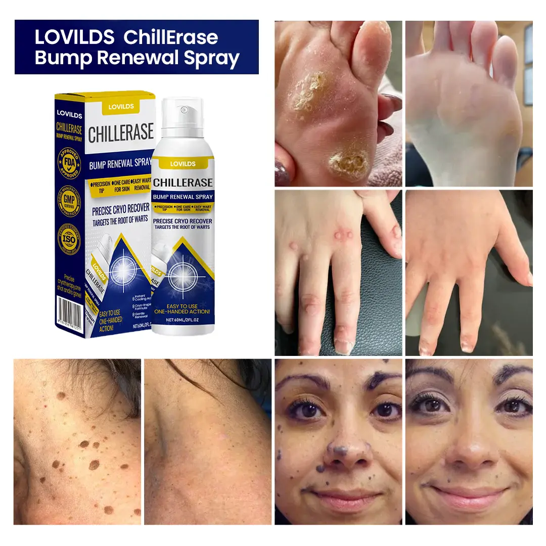ChillErase Bump Renewal Spray - Image 2
