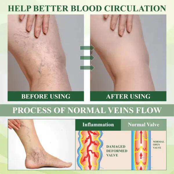 CircuHerb Edema Soothing & Healing Balm - Image 8
