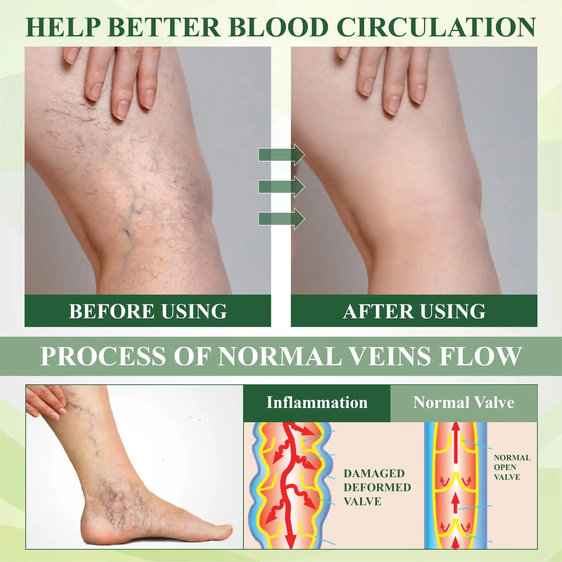 FluidEase Leg Therapy Edema Cream - Image 6
