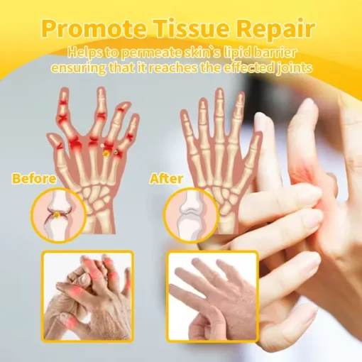 Bee Venom & Turmeric Arthritis Therapy Cream - Image 13