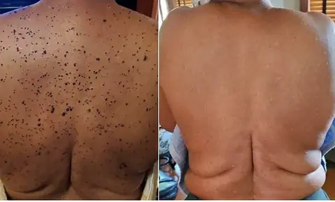 Bee Venom Skin Treatment Cream - Image 3
