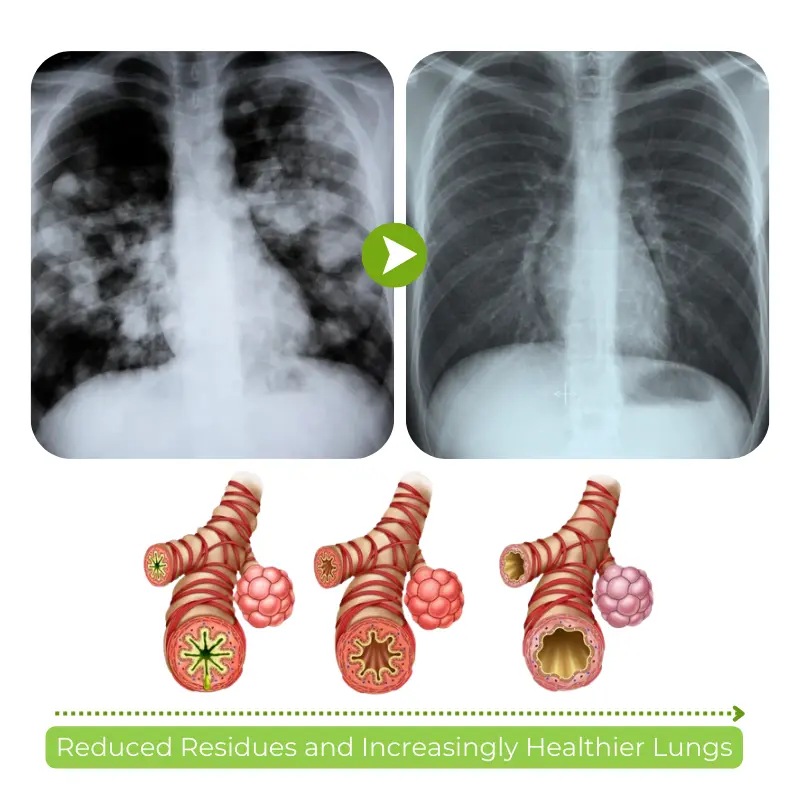 RespiCleanse Herbal Lung Detox Inhaler. - Image 5